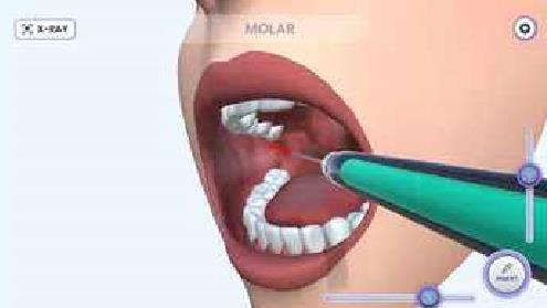 牙医模拟中文版